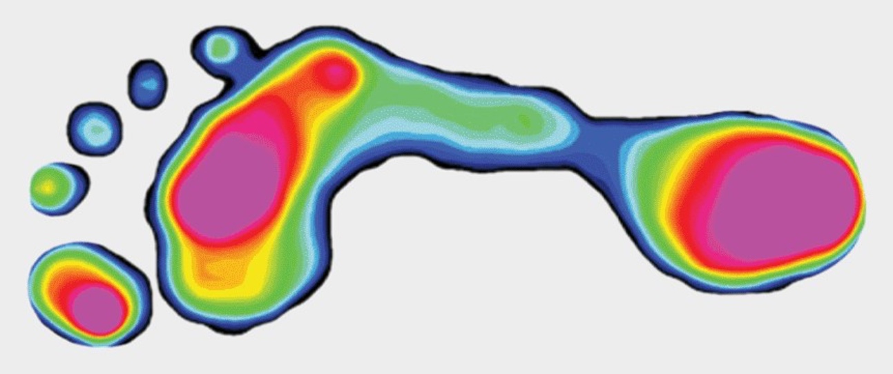 Pressure map of a healthy foot