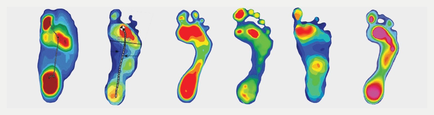 Pressure maps across six foot conditions